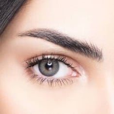 Contact Lenses Contact Lenses -