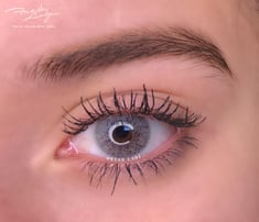 Contact Lenses Contact Lenses -